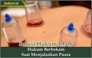 Hukum Berbekam Saat Menjalankan Puasa