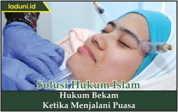 Hukum Bekam Ketika Menjalani Puasa