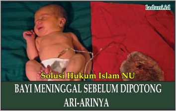 Hukum Penanganan Bayi Meninggal sebelum Dipotong Ari-arinya