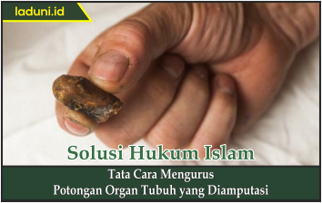 Tata Cara Mengurus Potongan Organ Tubuh yang Diamputasi