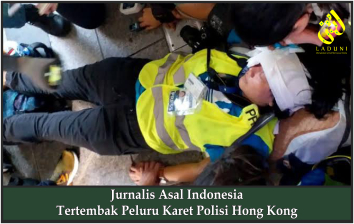 Jurnalis Asal Indonesia Tertembak Peluru Karet Polisi Hong Kong