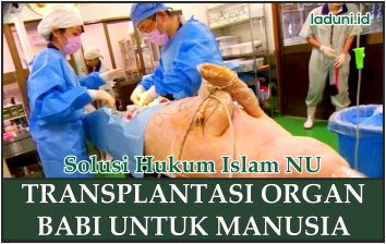 Transplantasi Organ Babi untuk Manusia