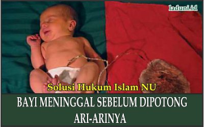Hukum Penanganan Bayi Meninggal sebelum Dipotong Ari-arinya