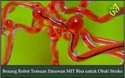 Benang Robot Temuan Ilmuwan MIT Bisa untuk Obati Stroke