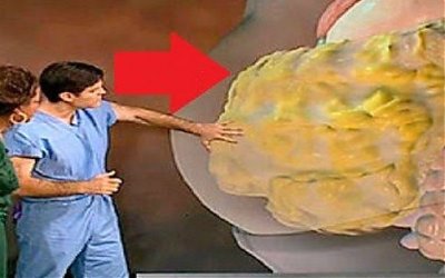 Bisakah Kebiasaan Jalan Kaki Bantu Luruhkan Lemak Perut?