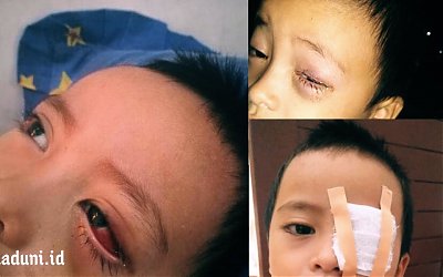 Kisah Seorang Ibu yang Menyesal Akibat Mata Buah Hatinya Alami Iritasi karena Kecanduan Gadget