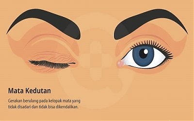 Benarkah Mata Kedutan Disebabkan Ada yang Menggibahi Kita?
