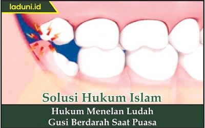 Hukum Menelan Ludah Gusi Berdarah Saat Puasa