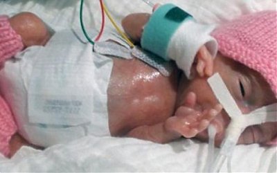 Bayi Terkecil di Dunia dari Jepang