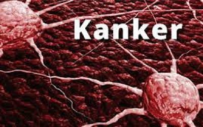 Beberapa Cara Simpel Dalam Menurunkan Risiko Kanker