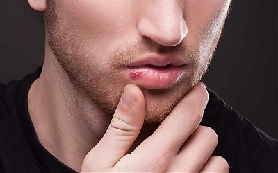 Cara Praktis Mencegah Keringnya Bibir Saat Berpuasa