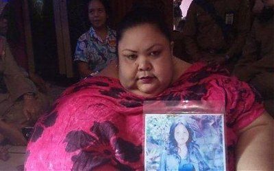 Mengenal Operasi Bariatrik yang Bantu Titi Wati Turunkan Berat Badan