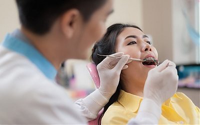 Bagaimana Hukumnya Meratakan Gigi untuk Kecantikan?
