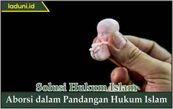 Aborsi dalam Pandangan Hukum Islam