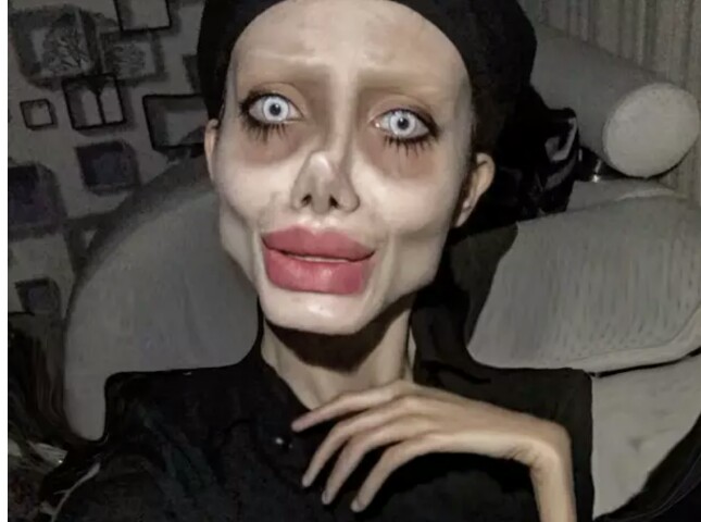 Angelina Jolie Masuk Rumah Sakit?
