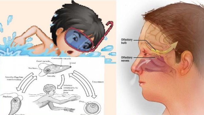 Penyakit Langka, Bocah Ini Tewas karena Otaknya Dimakan Amuba