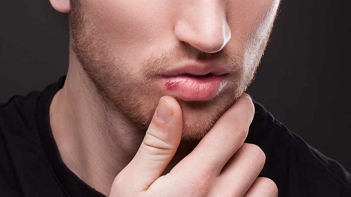 Cara Praktis Mencegah Keringnya Bibir Saat Berpuasa