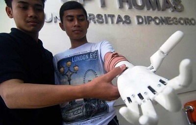 Undip Semarang Ciptakan Tangan Bionik untuk Difabel